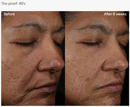 paula before and after1